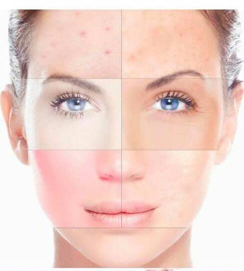 Empezó Temporada de Peeling 2020