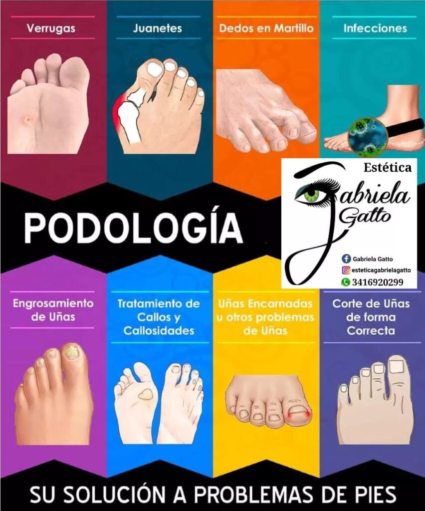 Podología